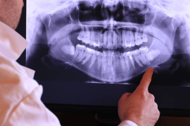 Best Emergency Broken Tooth Repair in Darlington, SC
